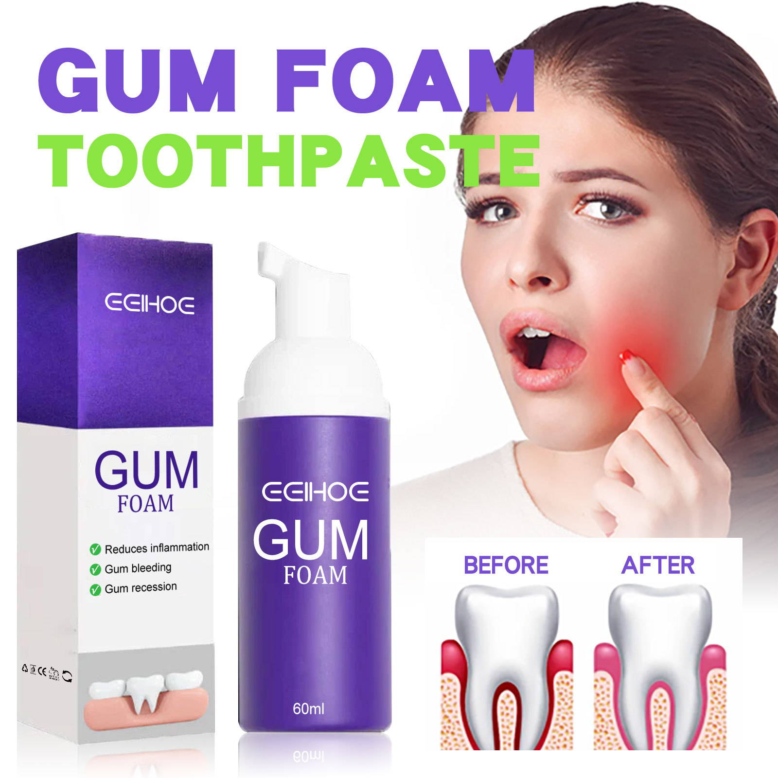 Teeth Whitening Yellow Teeth - 60ml Teeth Whitening Mousse V34 Teeth