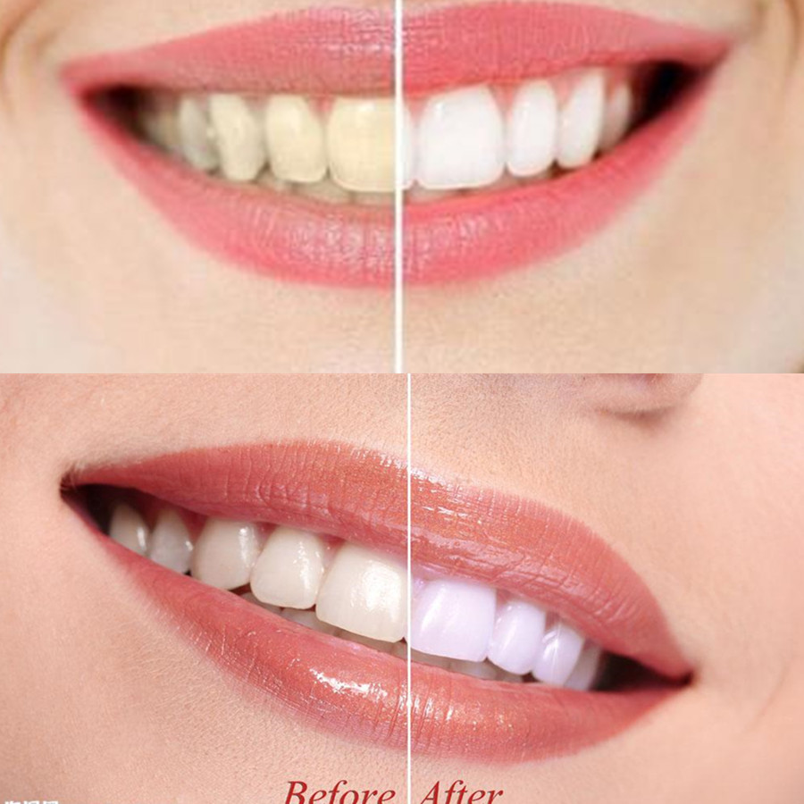 Bamboo Charcoal Teeth Tooth De - Teeth Whitening Filter ulasan dan harga