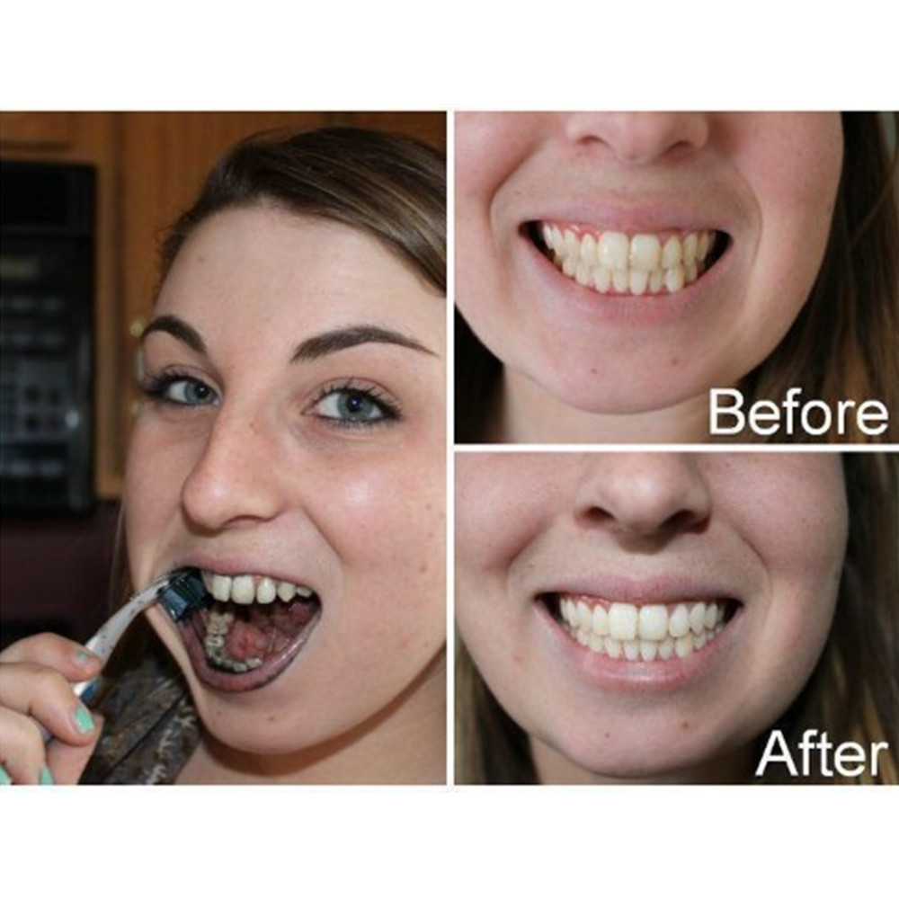 Bamboo Charcoal Teeth Tooth De - Teeth Whitening Filter ulasan dan harga