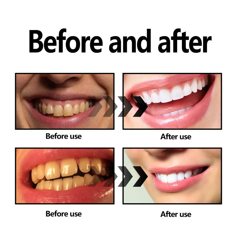 Bamboo Charcoal Powder Teeth N - Teeth Whitening Filter ulasan dan harga
