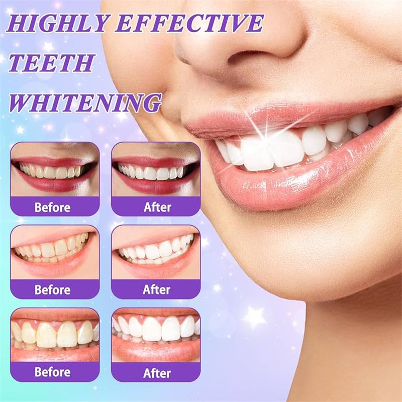 9D Purple Teeth Whitening Toot - Teeth Whitening That Works ulasan dan harga
