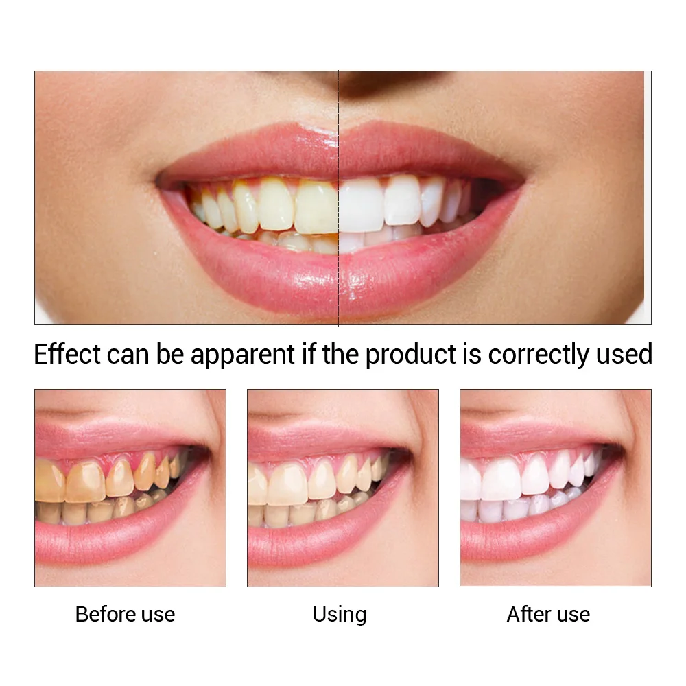 FTEENPLY Teeth Whitening Essen - Teeth Whitening Q&M ulasan dan harga