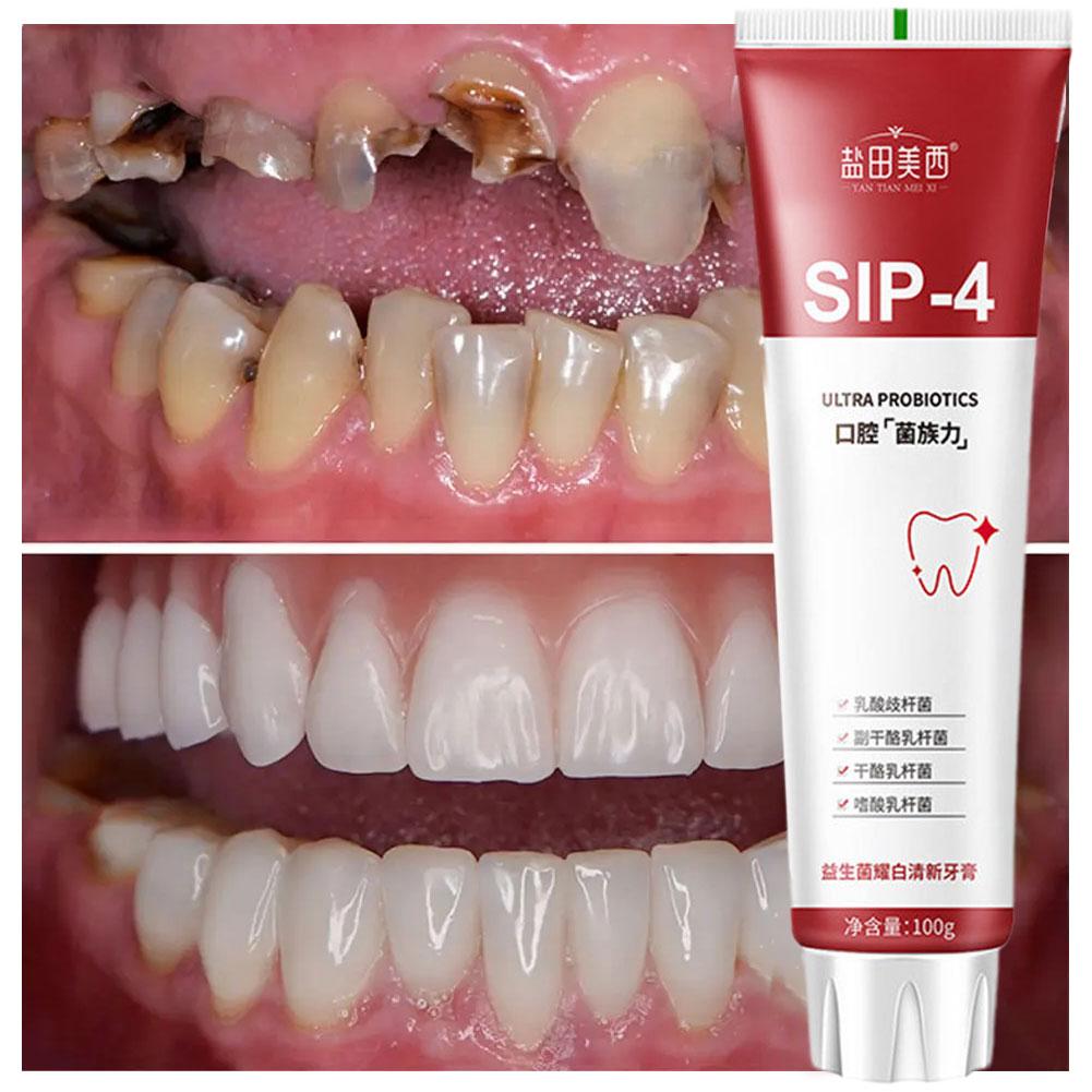 100g Sip-4 Probiotic Whitening - Teeth Whitening Yellow Teeth ulasan dan harga
