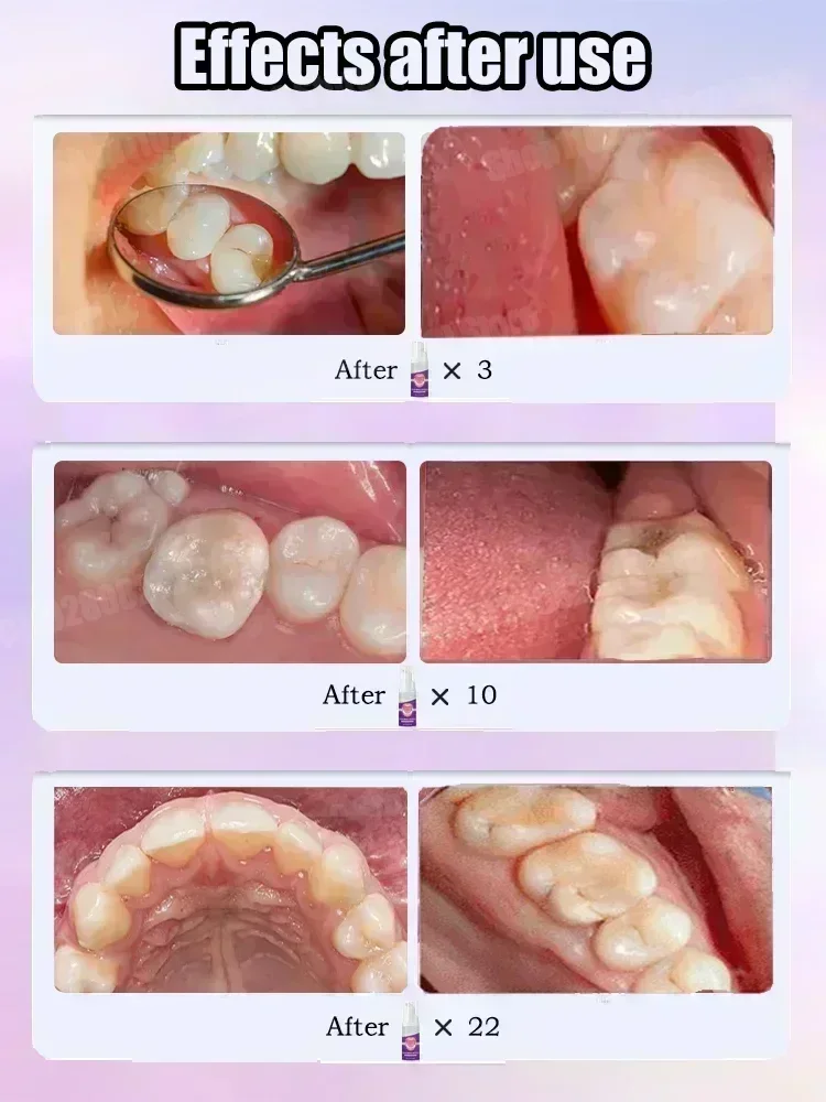 Hot sales Best-selling, Scient - Teeth Whitening That Works ulasan dan harga