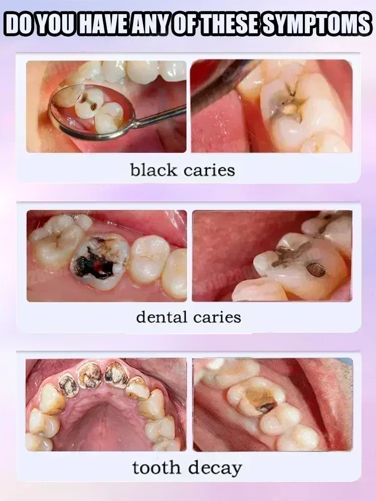 Hot sales Best-selling, Scient - Teeth Whitening That Works ulasan dan harga