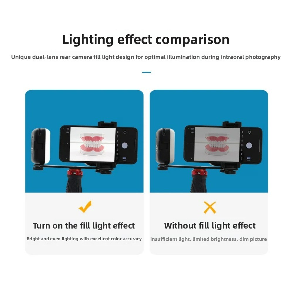 Dental Photography Light, Blue - Teeth Whitening Kit ulasan dan harga