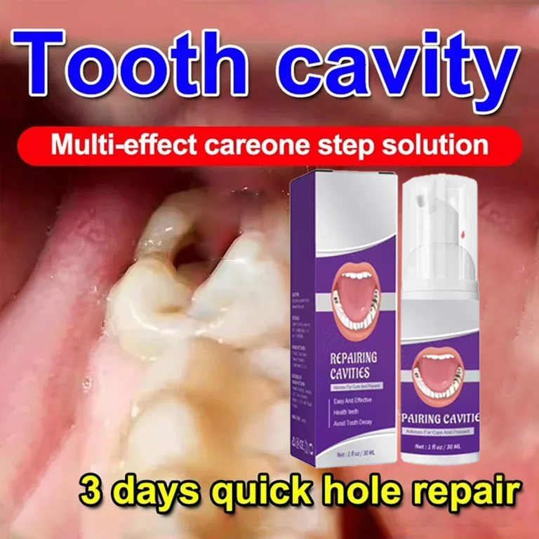 Teeth Cleaning Toothpaste Remo - Teeth Whitening That Works ulasan dan harga